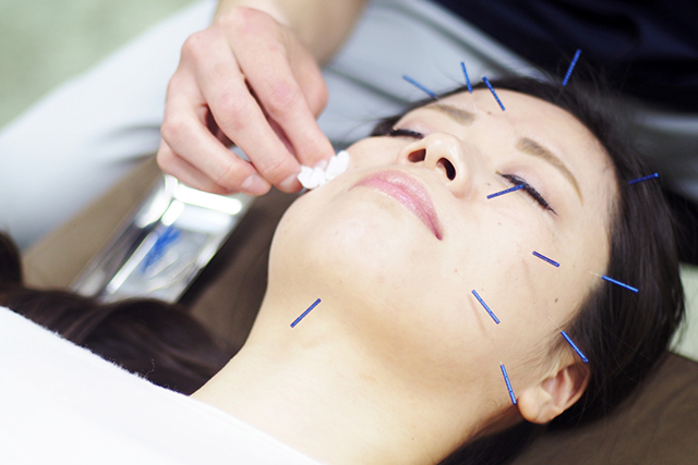 The demand for medical beauty industry is rising, and Jiaxing Xintong Beauty Medical Needle seizes the market with quality